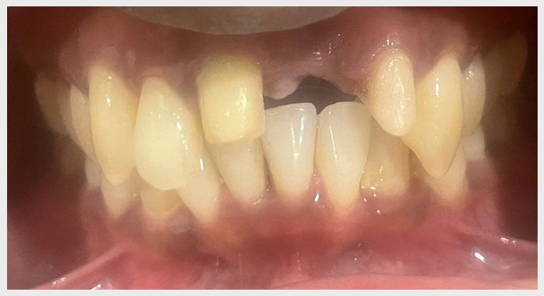 V.Chandrika Dental Clinic